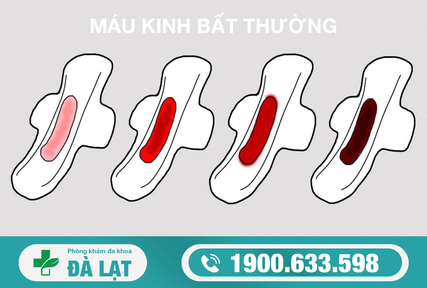 Hình ảnh minh họa